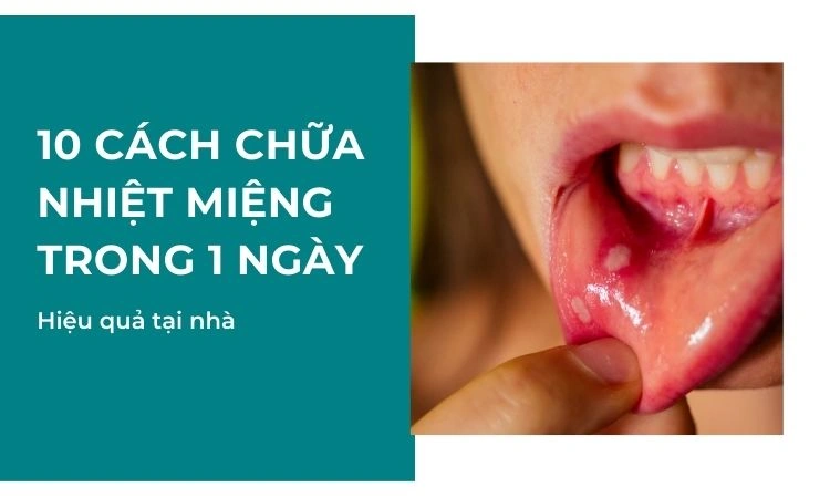 Chữa nhiệt miệng nhanh chóng bằng cách áp dụng phương pháp dân gian 