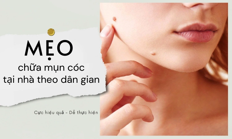 10 mẹo chữa mụn cóc theo dân gian cực hiệu quả