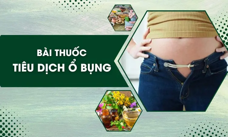 X. Câu hỏi thường gặp về sốt xuất huyết tràn dịch ổ bụng