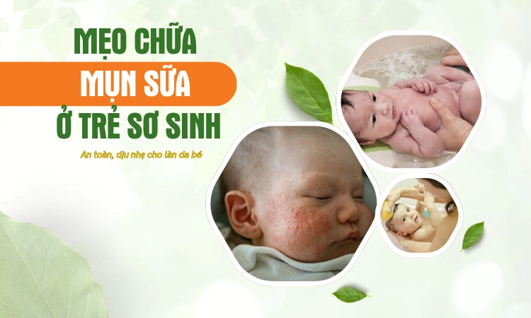 Khám phá cách chữa mụn sữa ở trẻ sơ sinh tại nhà