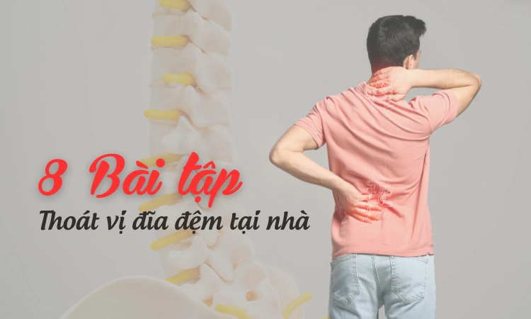 Những bài tập giúp giảm đau lưng thoát vị đĩa đệm lưng