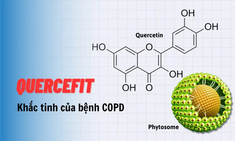 Tìm hiểu về hoạt chất đặc biệt Quercefit